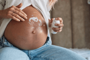 stretch mark